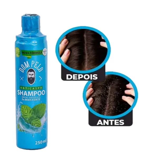 Shampoo Anticaspa Dom Pelo – Limpeza Profunda, Controle da Oleosidade e Alívio da Coceira 250ml - Image 3